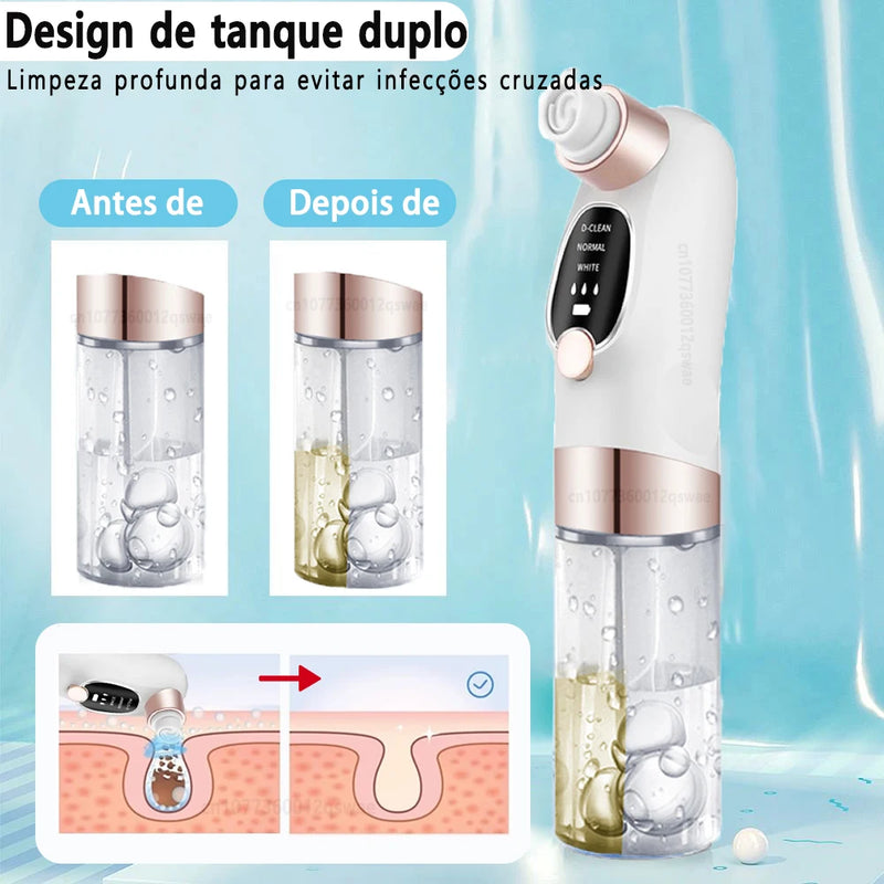 Blackhead Remover Pore Vacuum Face Cleaner Electric Pimple Acne Black Head Removal USB Rechargeable Water Cycle Black Dot Remove