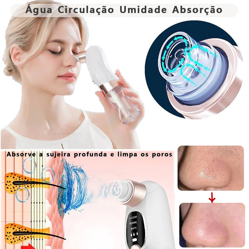 Blackhead Remover Pore Vacuum Face Cleaner Electric Pimple Acne Black Head Removal USB Rechargeable Water Cycle Black Dot Remove